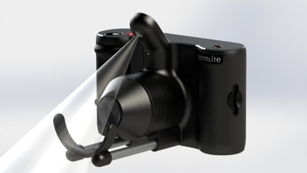 DermLite - MoleSafe camera